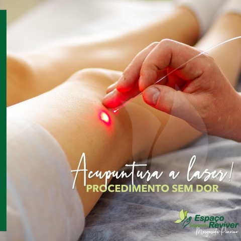 Acupuntura a lase